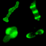 Biología Celular y Molecular de Streptococcus pneumoniae