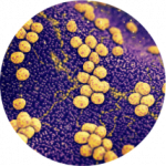 Epidemiología molecular, resistencia a los antimicrobianos y patogénesis de Staphylococcus aureus