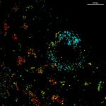 Inmunobiología de los linfocitos B