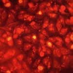 Bacteriología - Microbiología celular y molecular de Chlamydia trachomatis