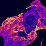 Microscopía