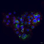 Transporte intracelular y homeostasis celular