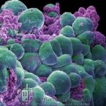 Oncogenesis y supresión tumoral